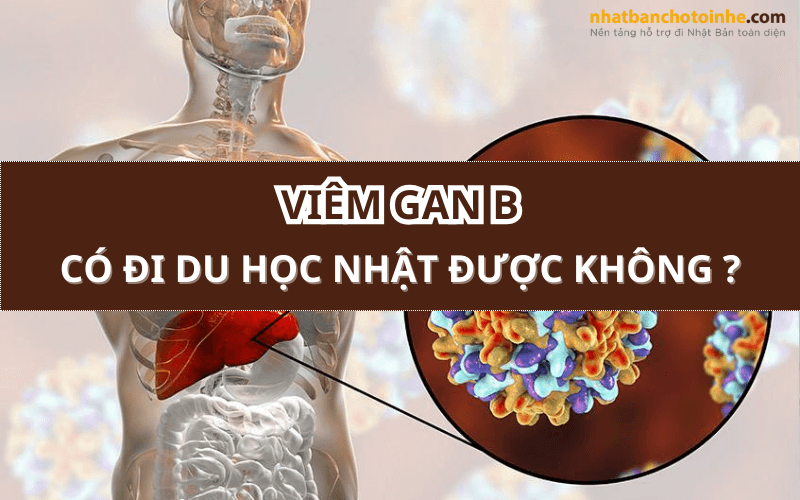 Viêm gan B có đi du học Nhật Bản được không